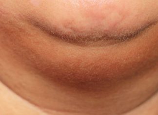 5 enfermedades que te sacan papada y todavía no lo sabes – MSN