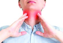 Cuidado con las infecciones de garganta, molestias y dolor podría necesitar más que una medicina de mostrador – El Latino SD