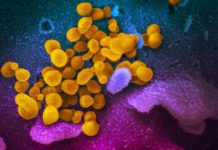 ¿Cuál es la diferencia entre una epidemia y una pandemia? – El Comercio (Ecuador)