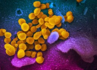 ¿Cuál es la diferencia entre una epidemia y una pandemia? – El Comercio (Ecuador)