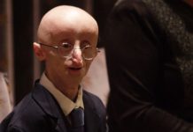 Las enfermedades raras afectan a 1 persona de cada 2.000. Estas son las más prevalentes en EE.UU. – CNN México.com