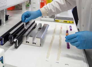 Lavarse las manos bien y varias veces al día, principal recomendación de Minsalud ante coronavirus – Noticias Caracol