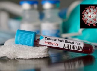 Autoridades de Utah confirman segundo caso de coronavirus en el estado – Telemundo Utah