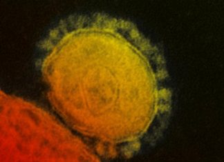 Esto es todo lo que debe saber sobre el coronavirus, un virus que se ha extendido en EEUU – MiamiDiario.com