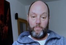 Coronavirus. Lo peor es la tos incontrolable: testimonio de paciente | El Universal – El Universal