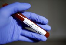 Una farmacéutica española anuncia tener listo un medicamento para probarlo contra el coronavirus – RT en Español