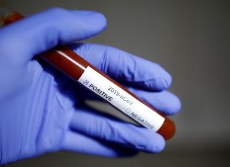 Una farmacéutica española anuncia tener listo un medicamento para probarlo contra el coronavirus – RT en Español