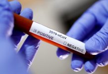 El científico que en 2015 advirtió sobre el nuevo coronavirus está buscando una cura y evalúa el actual brote – RT en Español