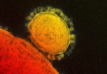 Hidroxicloroquina y Remdesivir, posibles fármacos para combatir al coronavirus | El Universal – El Universal