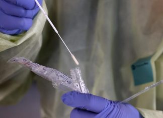 Una peligrosa “prueba de autocomprobación” del coronavirus está circulando en las redes sociales. He aquí por qué deberías evitarla – CNN México.com