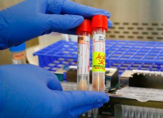 Síntomas del coronavirus: esta es la lista completa para saber cuándo pedir ayuda – CNN México.com