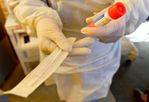 Aunque quisieras hacerte una prueba de coronavirus, esta es la razón por la cual tu médico probablemente no te la hará – CNN México.com