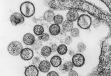 ¿Qué son los hantavirus y cuál es su relación con las ratas? | El Universal – El Universal