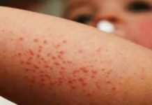 Cuáles son los factores que podrían agravar una crisis de salud en la CDMX – infobae