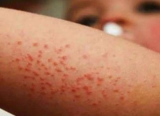 Cuáles son los factores que podrían agravar una crisis de salud en la CDMX – infobae