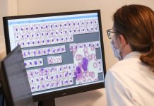 Por qué Suecia dejó de hacer tests a todos los que tienen síntomas de estar infectados con el coronavirus – infobae