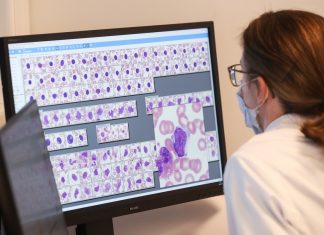 Por qué Suecia dejó de hacer tests a todos los que tienen síntomas de estar infectados con el coronavirus – infobae