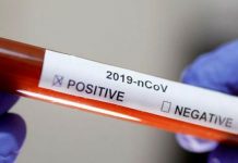 Confirman caso positivo a coronavirus en Hospital Civil de Culiacán; está grave – Linea Directa