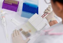 Preguntas y respuestas sobre las pruebas y los kits para detectar el coronavirus – CNN México.com