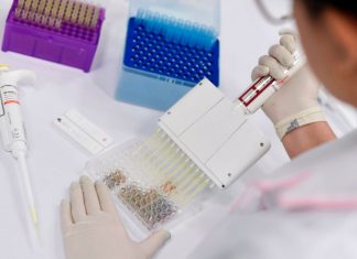 Preguntas y respuestas sobre las pruebas y los kits para detectar el coronavirus – CNN México.com