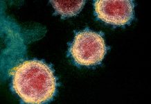 Una niña de 4 años, sin síntomas, positivo en coronavirus – Diario Médico