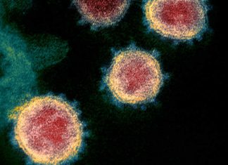 Una niña de 4 años, sin síntomas, positivo en coronavirus – Diario Médico