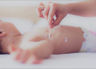 Sarampión: ¿Qué es, cuáles son los síntomas, causas, complicaciones y cómo prevenirlo? – Noticieros Televisa