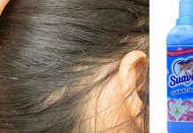 Cómo eliminar piojos y liendres con suavizante – Salud180
