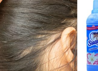 Cómo eliminar piojos y liendres con suavizante – Salud180