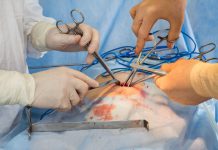 ¿Cómo funciona la cirugía para combatir la diabetes? – La Raza Chicago