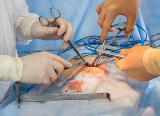 ¿Cómo funciona la cirugía para combatir la diabetes? – La Raza Chicago