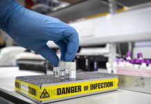 «Una nueva era en la medicina»: médicos editan el ADN de un paciente para intentar curarle la ceguera – Univision